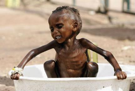 Over 20 million people facing starvation - and we should care! - Marriage &  Family - Home & Family - News - Catholic Online
