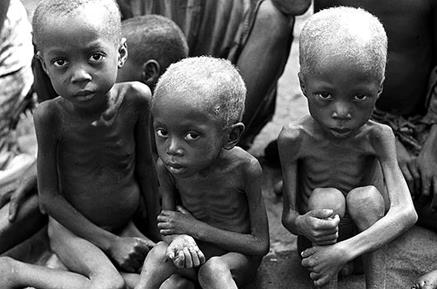 Friendly reminder that 37 million people die a year from starvation or  starvation related causes even though we have enough of a food surplus to  feed an extra billion people. Yay international