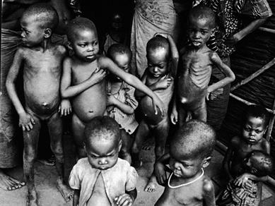 Hunger and Starvation Across the World is Affecting Half of Human Race