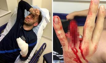 GRAPHIC CONTENT: Man's finger ripped off by wedding ring on iron fence | UK  | News | Express.co.uk