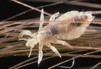 Image result for head lice