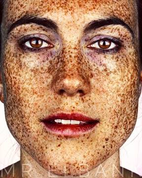 Image result for  freckle face